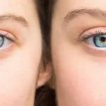 Kondisi Kebutaan Seseorang Karena Hilangnya Penglihatan