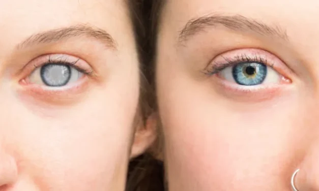 Kondisi Kebutaan Seseorang Karena Hilangnya Penglihatan