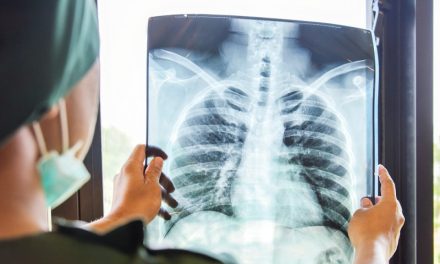 Gelombang Elektromagnetik Yang Di Gunakan Dalam X-ray