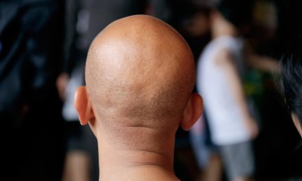 Gaya Rambut Botak Pada Seseorang Terlihat Bersih