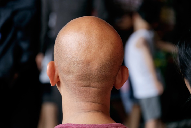 Gaya Rambut Botak Pada Seseorang Terlihat Bersih