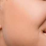 Kondisi Wajah Tembem Terutama Bagian Pipi