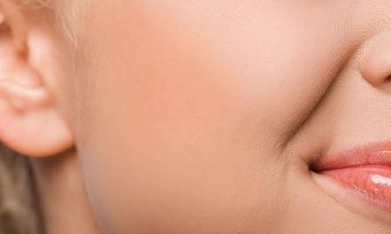 Kondisi Wajah Tembem Terutama Bagian Pipi